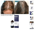 FEG Hair Growth Spray with Biotin & Caffeine – Scalp Nourishing Hair