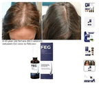 FEG Hair Growth Spray with Biotin & Caffeine – Scalp Nourishing Hair