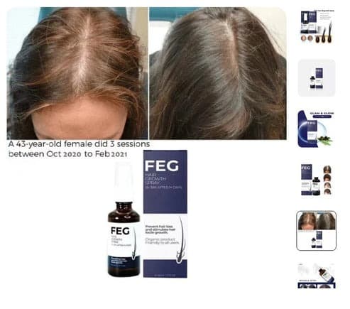 FEG Hair Growth Spray with Biotin & Caffeine – Scalp Nourishing Hair