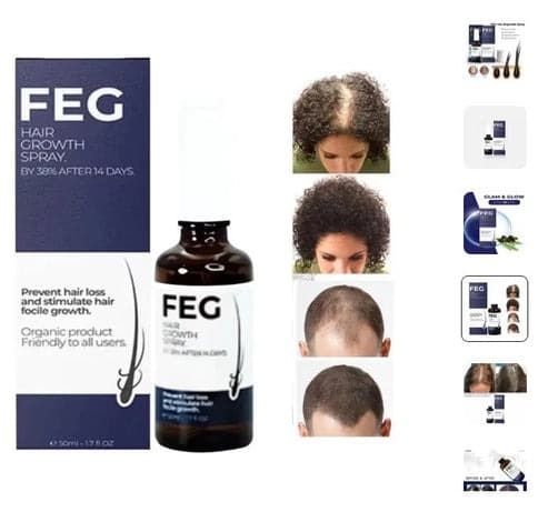 FEG Hair Growth Spray with Biotin & Caffeine – Scalp Nourishing Hair