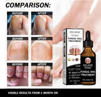 EELHOE Fungal Nail Treatment Oil – Extra Strong Nail Repair Care, 30ml