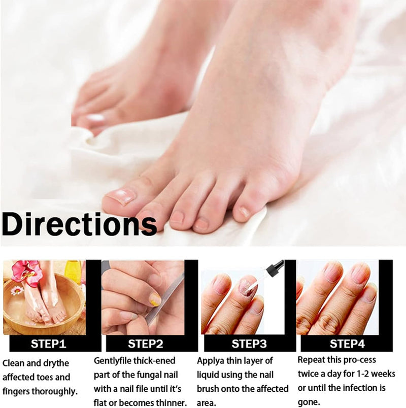 EELHOE Fungal Nail Treatment Oil – Extra Strong Nail Repair Care, 30ml